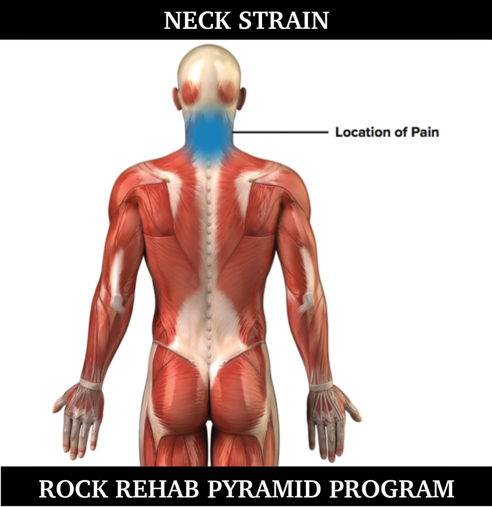 strain of neck muscle icd 10 code