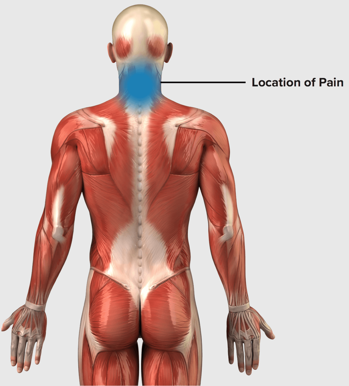 Neck Strain Protocol For Rock Climbers